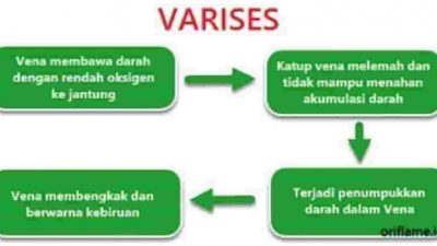 Nah buatlah contoh diagram alur terhadap penyakit lainnya yang dapat mengganggu organ peredaran darah tubuh manusia